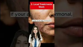 How to Fix Stress Acne - Stress Acne Remedies #acne #shorts