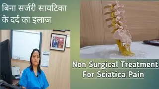 Non Surgical ways to manage Sciatica Pain II  बिना सर्जरी सायटिका के दर्द का इलाज II Pain clinic