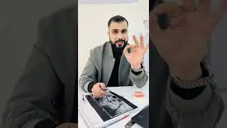 Study models (عملي (جداً مهم