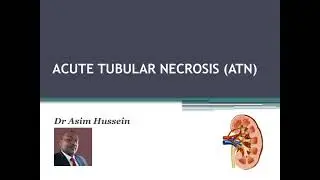 ACUTE TUBULAR NECROSIS ATN