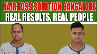 From Thin to Thick &ndash; Bangalore Hair System Magic! | HAIR PATCH FIXING