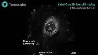Nuclear rotation and endocytosis in CHO cell - Label free 3D Live Cell Imaging
