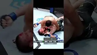 WORST STOPPAGE IN UFC HISTORY
