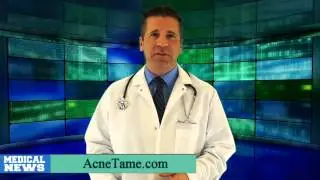 Acnetame Reviews- Best Over the Counter Acne Pills