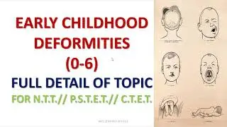 EARLY CHILDHOOD DEFORMITIES ( 0- 6 YEARS )