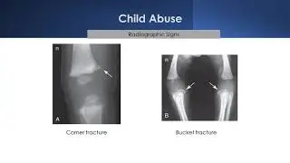 Pediatric Radiography