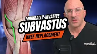 Is Knee Replacement Really the Only Fix for Arthritis?