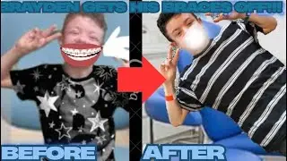 BRAYDEN finally gets his BRACES off after 2 years + a RETAINER! (SHOCKING!!) W/ the Clarke family 5