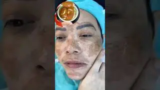 💯Face Pack For Tan Free Glowing Skin   Glowing Skin Tips #shorts #skincare #glowingskin #Glowing