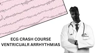 ECG CRASH COURSE- Ventricular Arrhythmias