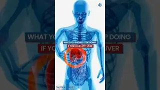 Things You MUST Stop Doing If You Have Fatty Liver 🛑❌ #FattyLiver #LiverHealth #DietTips