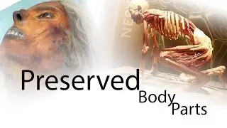 Top 5 Famous Persons Body Parts Preserved