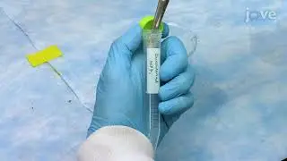 Studying Normal Tissue Radiation Effects using Extracellular Matrix Hydrogels