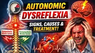 Autonomic Dysreflexia Simplified in English | Nursing, Physio & MBBS