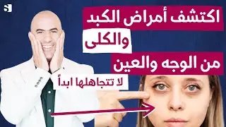 عشرة علامات تحذيرية في الوجه والعينين تدل على امراض خطيرة في الكبد والكلى