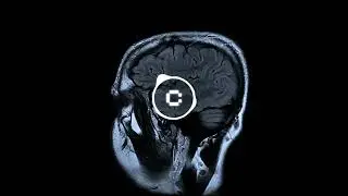 Apotech - You Lose My Mind (Official Visualizer)