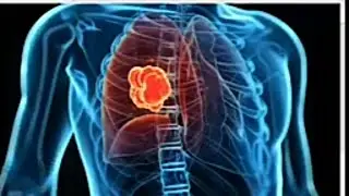 Aap jane plasma  therapy  tretment on corona virus