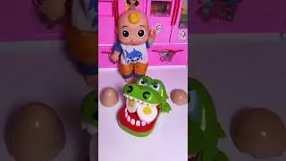 ASMR Unboxing Boys Unboxing Egg Kitchen Set Toys Satisfying