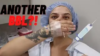 BBL WITH DR.JUNG *GRAPHIC* : VLOGMAS DAY 5
