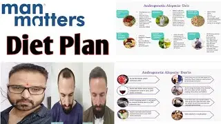 Man matters diet plan. Best diet plan for hair regrowth?
