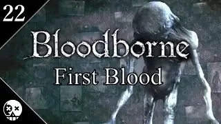 Bloodborne: First Blood (22) - Research Hall & Living Failures