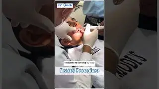Complete braces procedure at Dr Modi&rsquo;s Dental Clinic