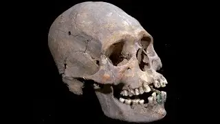The Woman of Tlailotlacan with elongated skull and encrusted teeth
