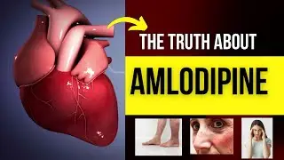 Каковы побочные эффекты АМЛОДИПИНА 10 мг 5 мг 2,5 мг и как уменьшить побочные эффекты?