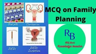 MCQ on Family Planning for Nursing Students#Different Methods#CoppertT#Best Time for IUCD Insertion#