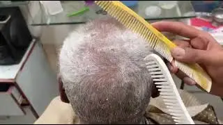 Dandruff hair Removal 🥵Clean Razor Head Shave with razor blade😰 bald head shave dandruff 24🤙🏻❤️