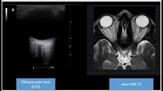 My Hands-on Brain U/S and TCCD Course