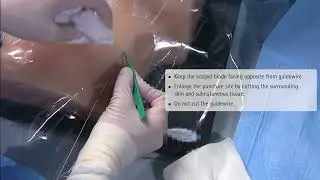 Certofix aguja valvulada y certodyn