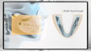 Henry Schein UK - CS 8100 from Carestream Dental