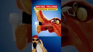 KETIKA TELINGA!! Berdengung permanen #physics #sains #education #science #earbuds @zackdfilms