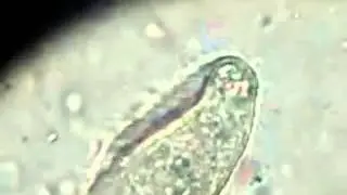 [Parasitology] Balantidium coli trophozoites - Movement in Wet Mount Preparation