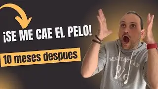 10 MESES TRAS EL TRASPLANTE: &iexcl;SE ME EST&Aacute; CAYENDO EL PELO! 😱