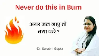First Aid of Burn at Home- Dr. Surabhi Gupta