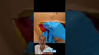 Le d&eacute;roulement d'une c&eacute;sarienne