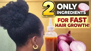 Only Two Ingredients | Best Onion juice for fast hair growth 