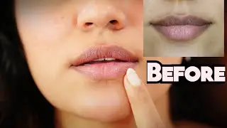 👄Как быстро удалить пигментацию губ!