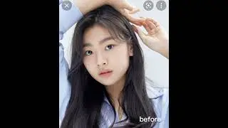 Kim su-an after before