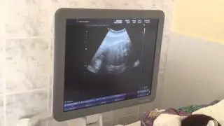 Ultrahang 8