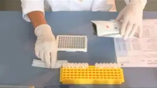 ORGENTEC ELISA  kits Diagnostic systems