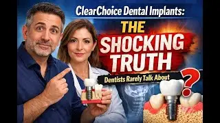 ClearChoice Dental Implants: The Shocking Truth Dentists Rarely Talk About