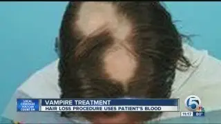 Vampire treatment