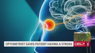 Eye doctor saves patient having stroke