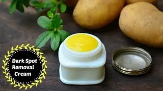 Remove DARK SPOTS With Potato & Turmeric Skin Brightening Face Cream