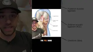 PCL Injury - Posterior Drawer Test #PCL #dashboardinjury #kneeinjury #sportsinjury