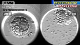 鳥取・米子市のクリニック　世界初の不妊治療法成功(20/05/23)