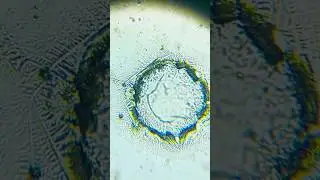 My dog's saliva under a microscope part 1, magnified 35x #microscope #magnifiedworld #microscopic